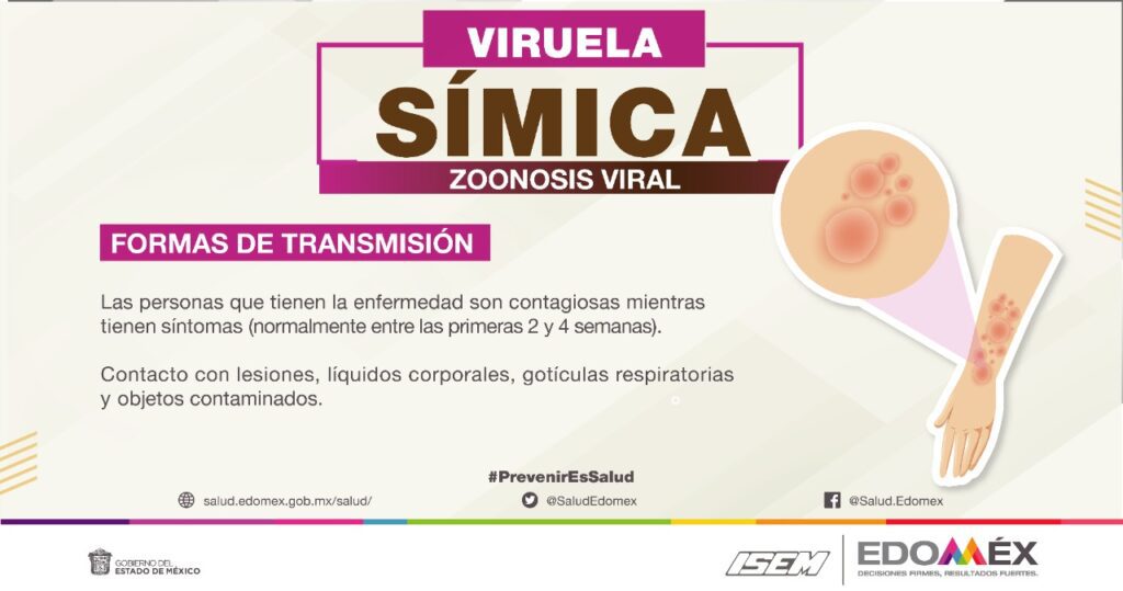¿Qué es la Viruela del Mono?